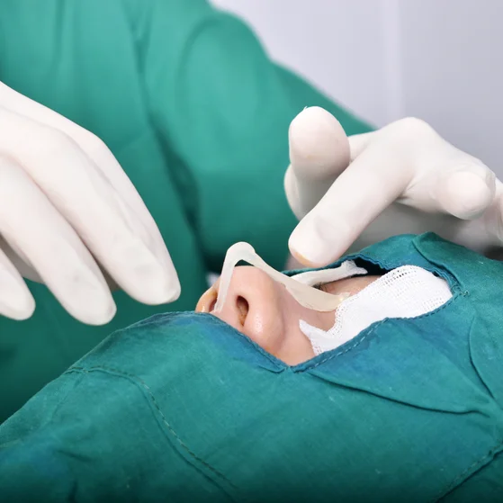 silicon nose surgery procedure