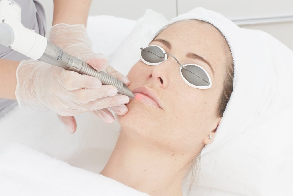 pico laser treatment procedure