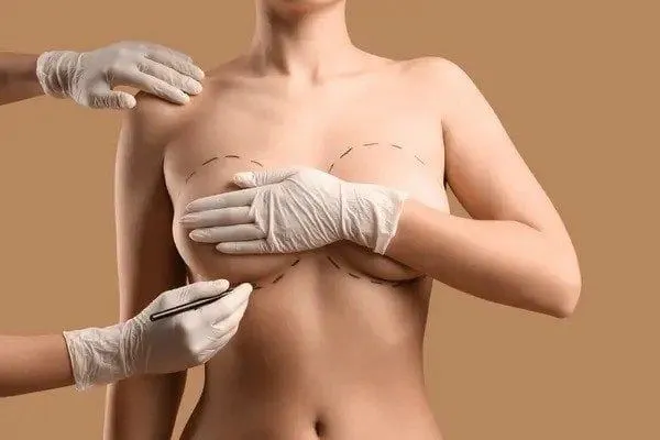 Cost of Breast Implants In Riyadh