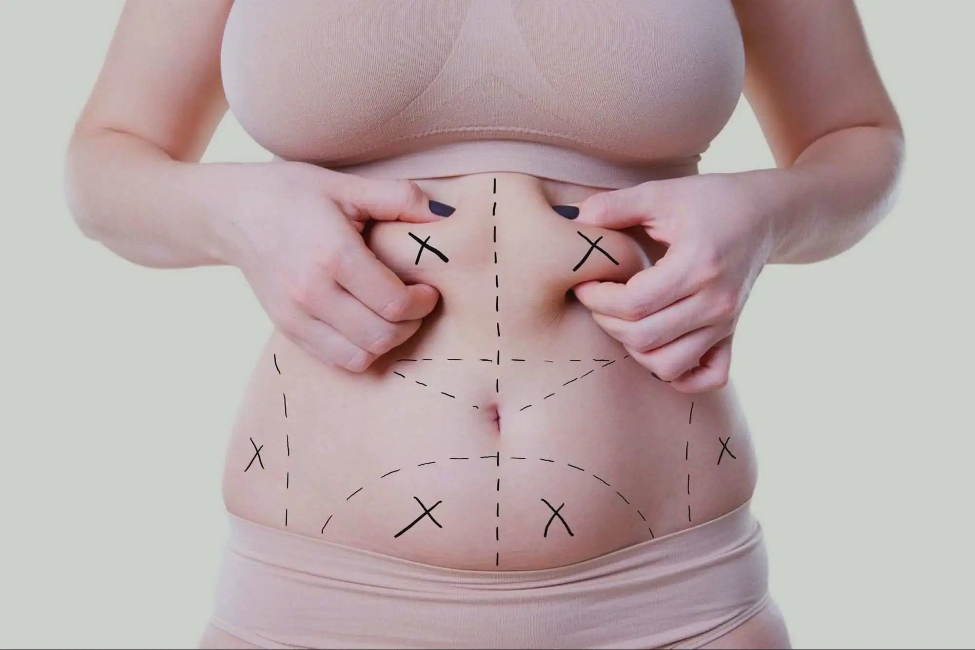 Laser Liposuction Cost in Riyadh, Saudi Arabia