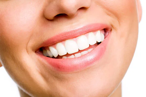 Does Teeth Whitening Work Permanently in Riyadh