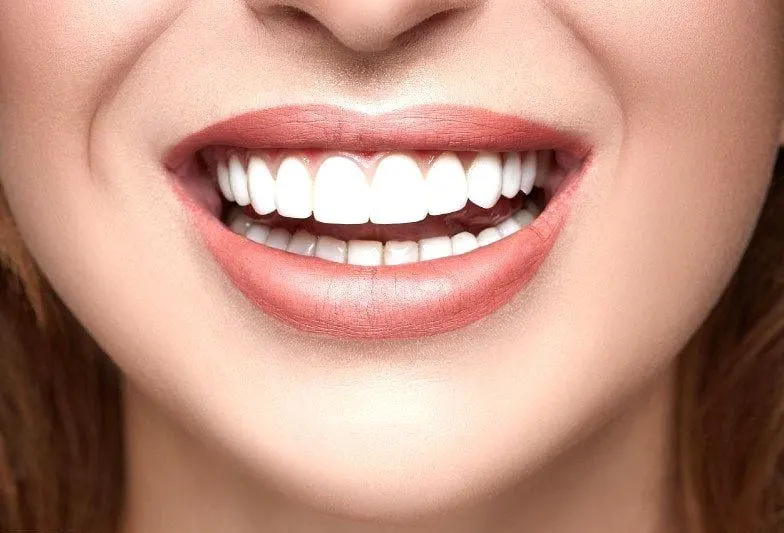 Emax Veneers Cost in Riyadh