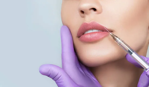 What to Expect after having lip filler