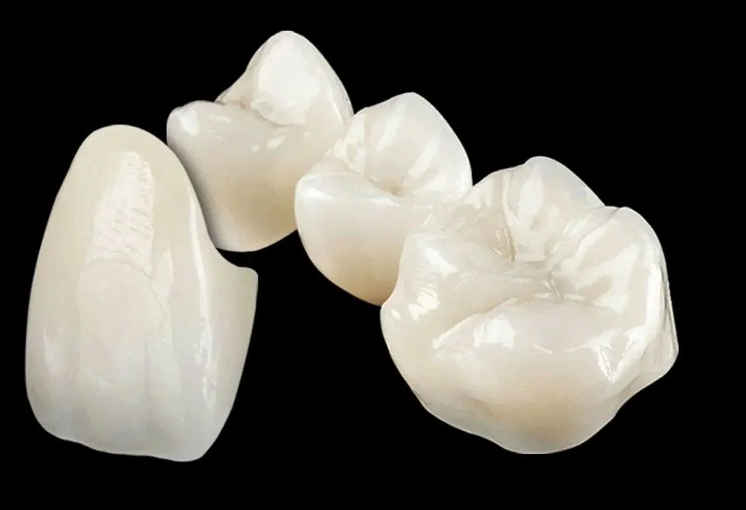 Zirconia Crown Cost in Riyadh