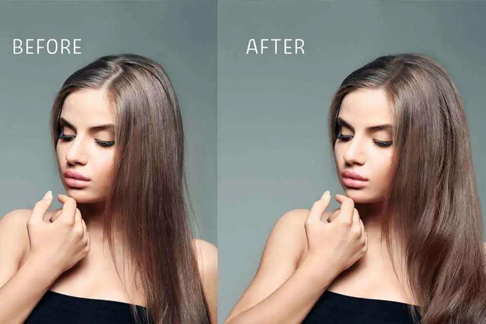 Female Hair transplant before after riyadh