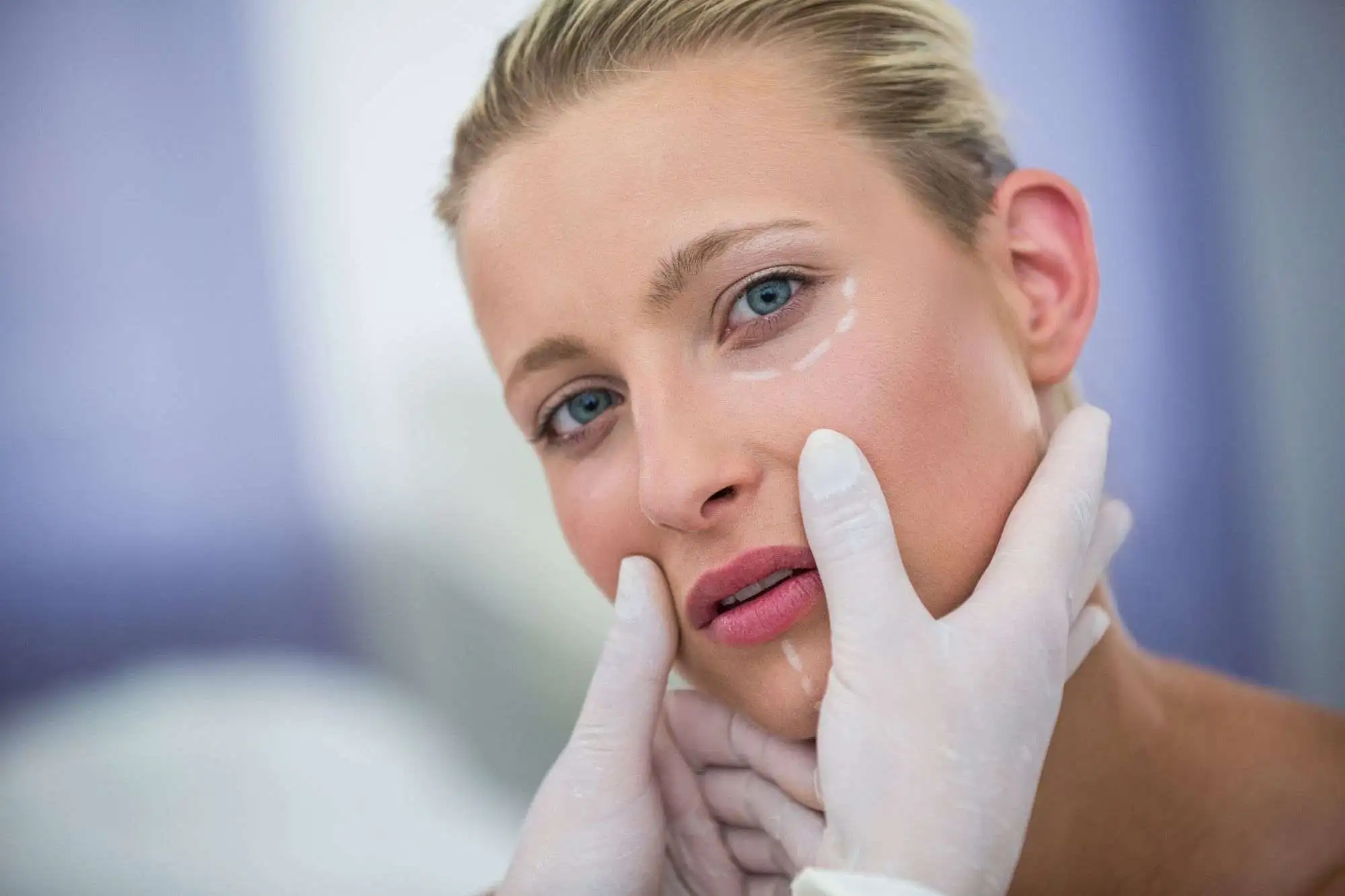Stem Cell Facelift cost in Riyadh