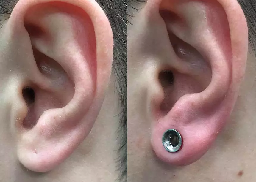 ear piercing before after results in riyadh