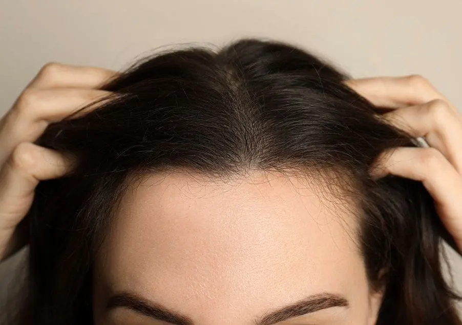 Female hair transplant Cost in riyadh