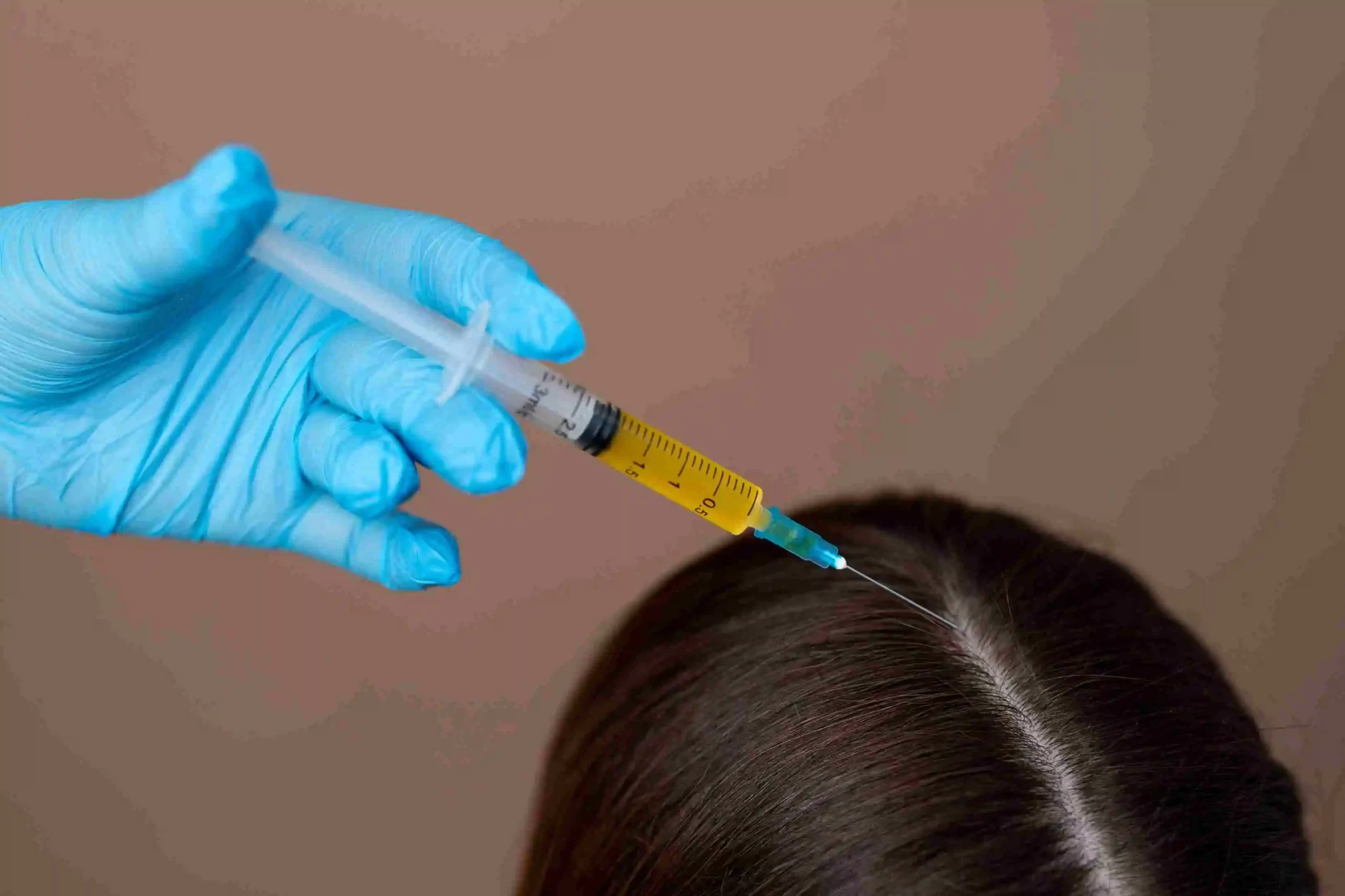 Acell Injections for Hair Growth in Riyadh