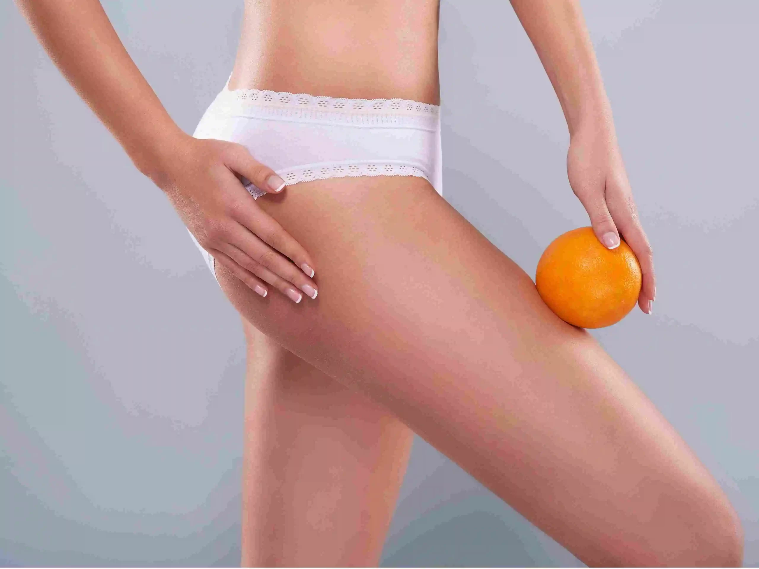 Cellulite Removal Treatment Cost in Riyadh