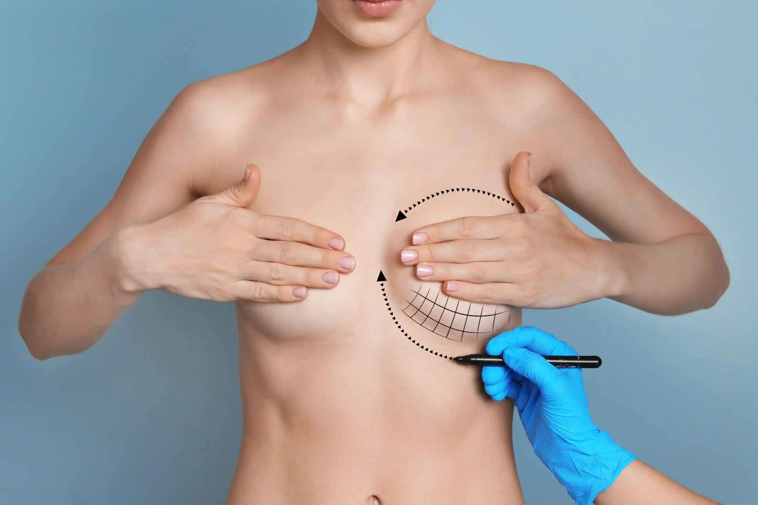 Silicone Breast implants in riyadh