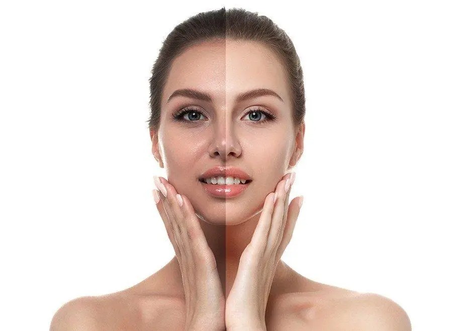 5D Skin Whitening Injections in Riyadh Jeddah Saudi Arabia Cost