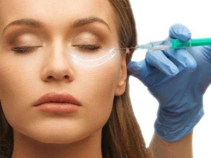 Eye Bag Removal Cost in Riyadh