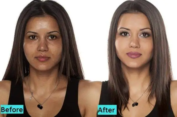 Glutathione injections before after results