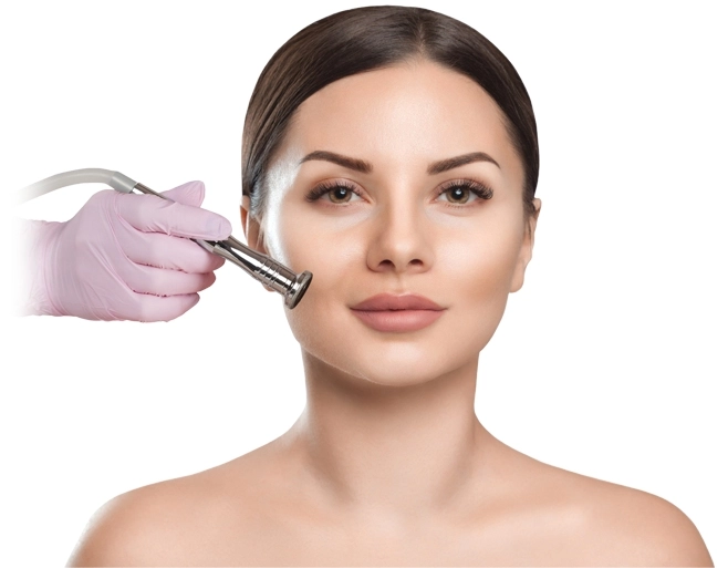 Micro dermabrassion treatment in riyadh