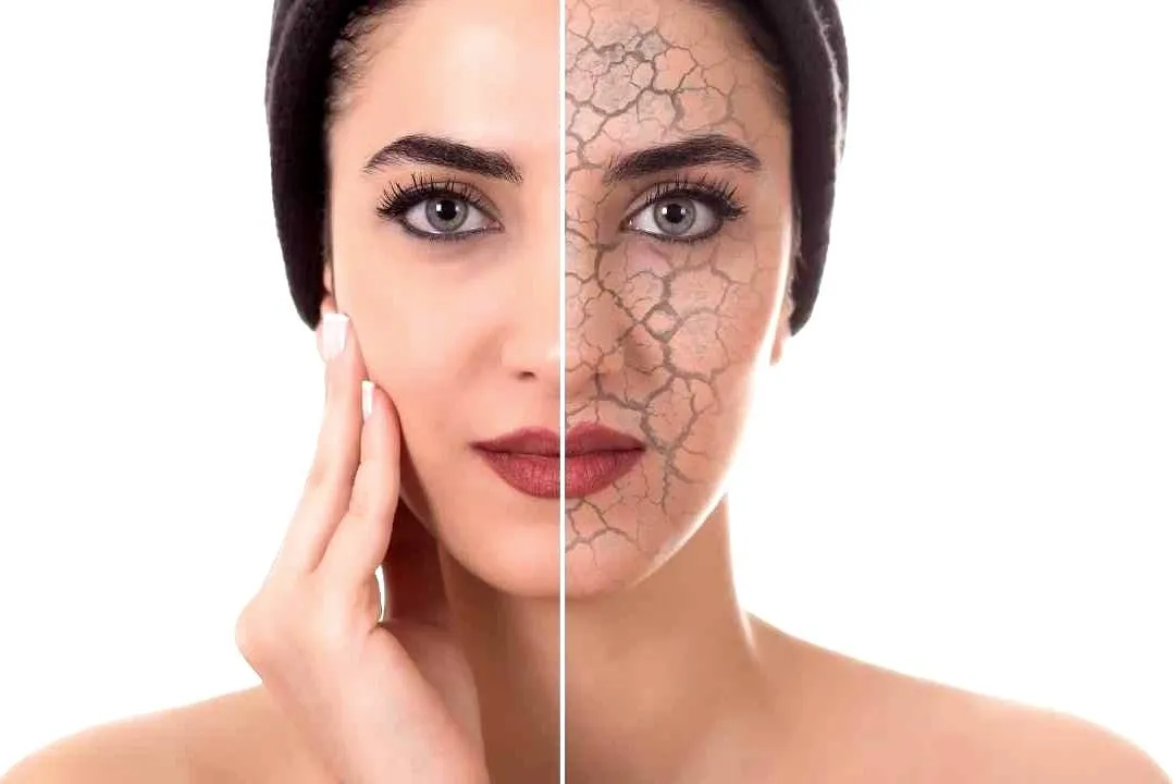 VISIA Skin Analysis Cost in Riyadh