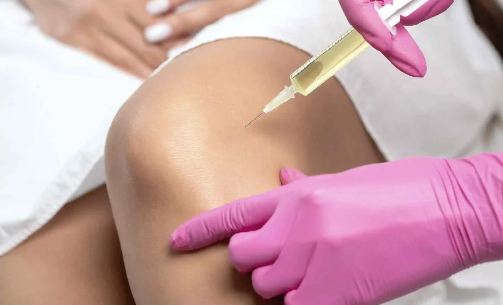 PRP Knees Injections in Riyadh Procedure