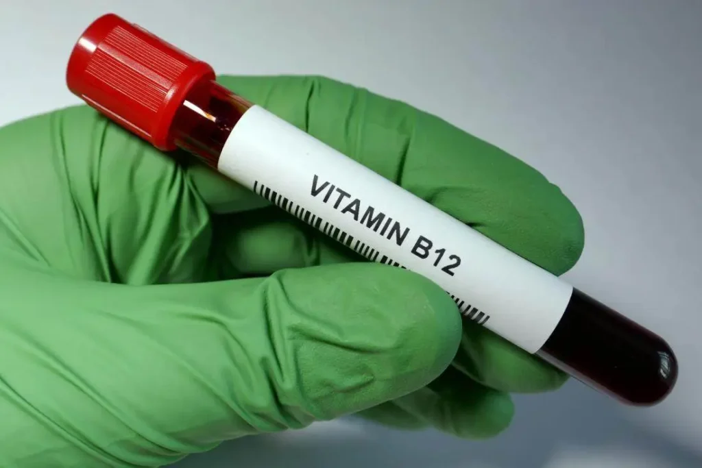 vitamin b12 procedure