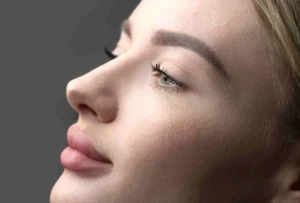 Liquid Rhinoplasty Can Fillers Reshape your Nose