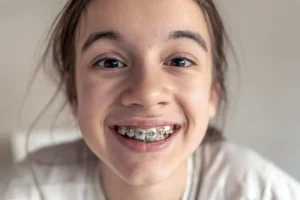 Difference Between Fixed Braces and Removable