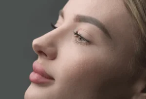 Liquid Nose Job Can Fillers Reshape Your Nose