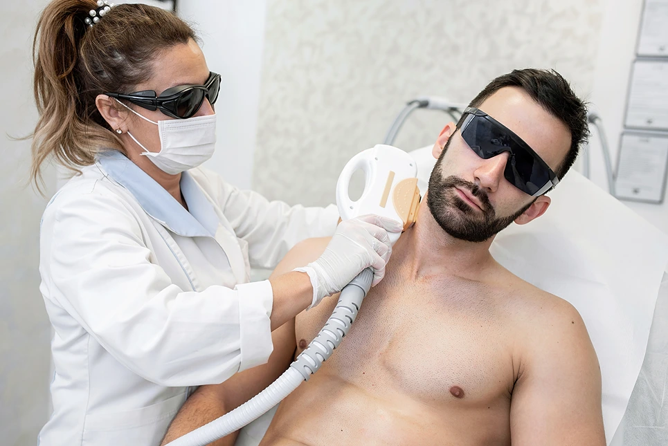 beard line laser hair removal procedure