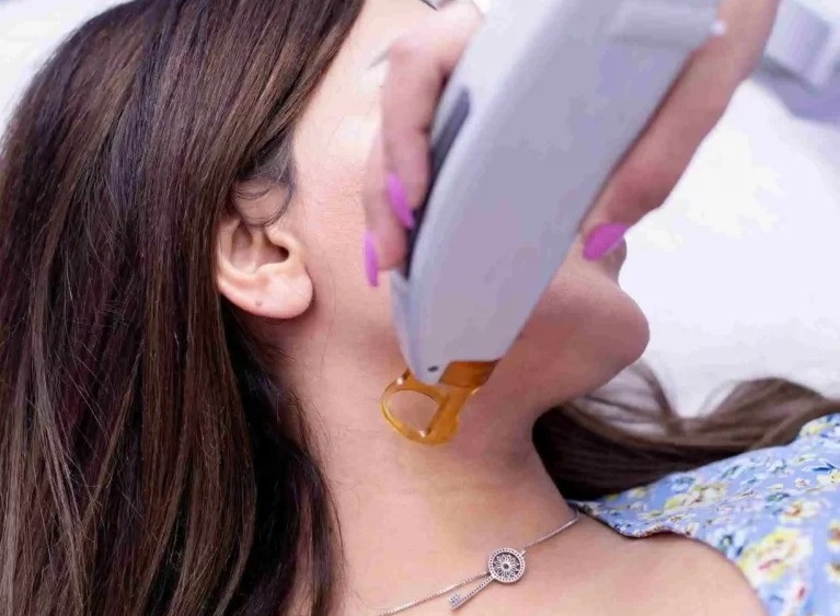 laser therapy procedure