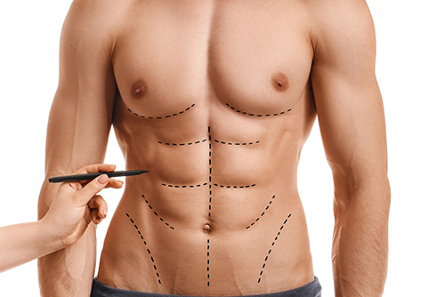 six pack abs procedure