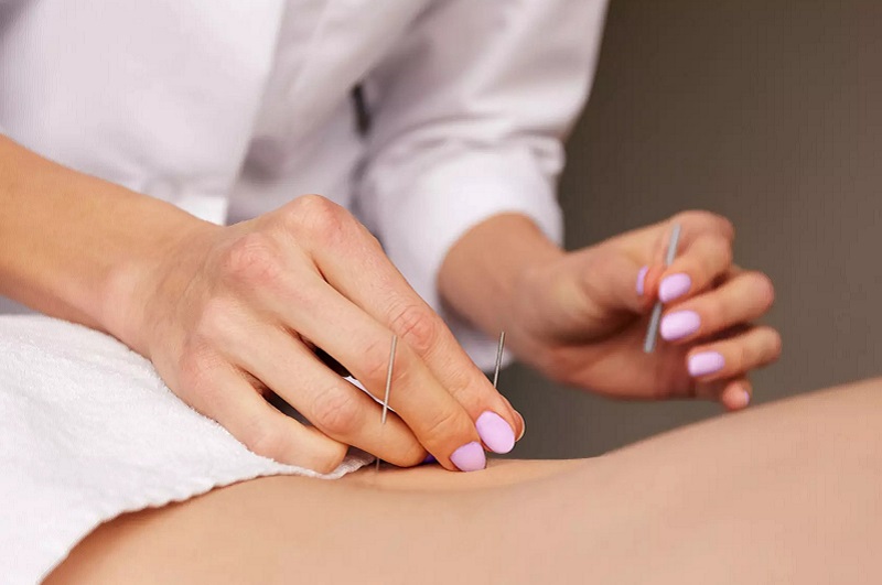 How Much Acupuncture Treatment Cost in Riyadh